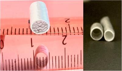 Transcatheter dilation and stenting of the modified blalock-taussig shunt in cyanotic heart diseases: points to consider. A single-center experience